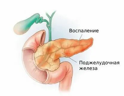 Можно прожить без поджелудочной