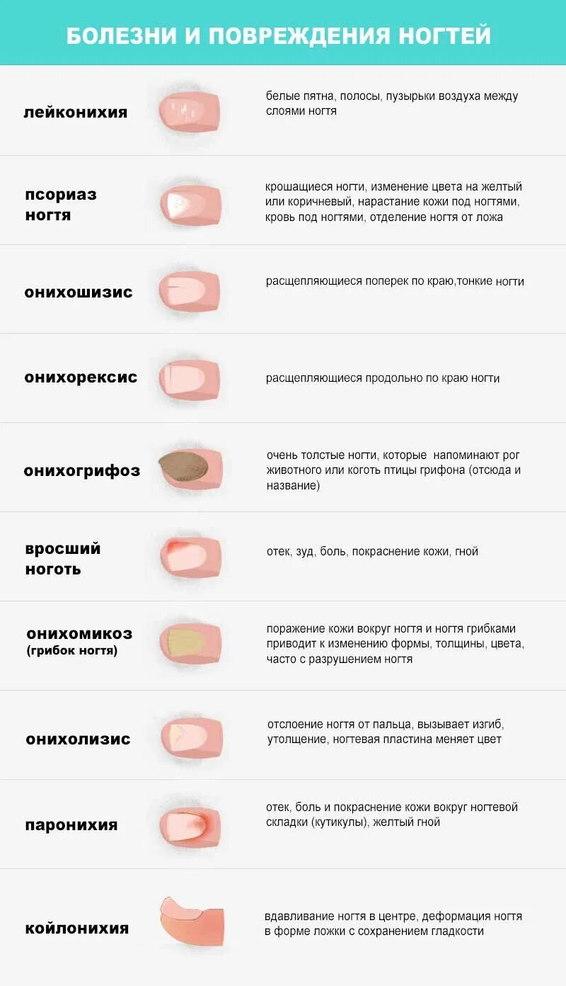 Цвет ногтей и их значение. Негрибковые заболевания ногтей таблица. таблица инфекционные заболевания ногтей. заболевания по ногтям рук. болезни ногтей на руках таблица.