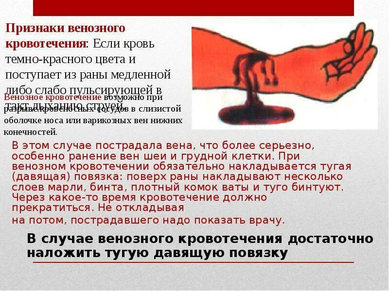При каком кровотечении применяется. Доклад на тему кровотечение. доклад на тему виды кровотечений. кровь при кровотечении.