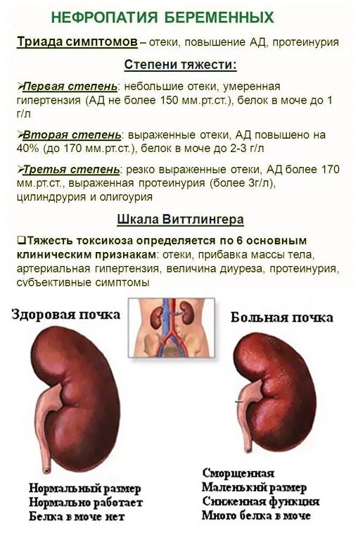 Симптомы поражения почек. Диабетическая нефропатия симптомы. Нефропатия клинические проявления. Нефропатия на УЗИ почек признаки. Диабетическая нефропатия (патология почек);.