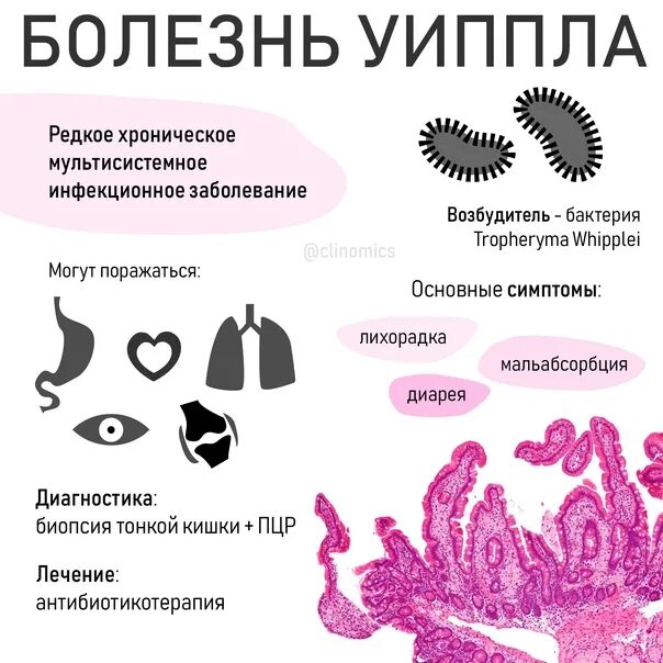 Болезнь уиппла клинические рекомендации 2022. Крутцфельда якова болещнь. Болезнь помпе клинические рекомендации. Гликогенозы биохимия симптомы. Болезнь бехчета у женщин.