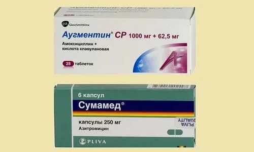 Чем отличается сумамед. Сумамед группа антибиотиков. азитромицин сумамед группа антибиотиков. аугментин или сумамед. сумамед к какой группе антибиотиков относится.