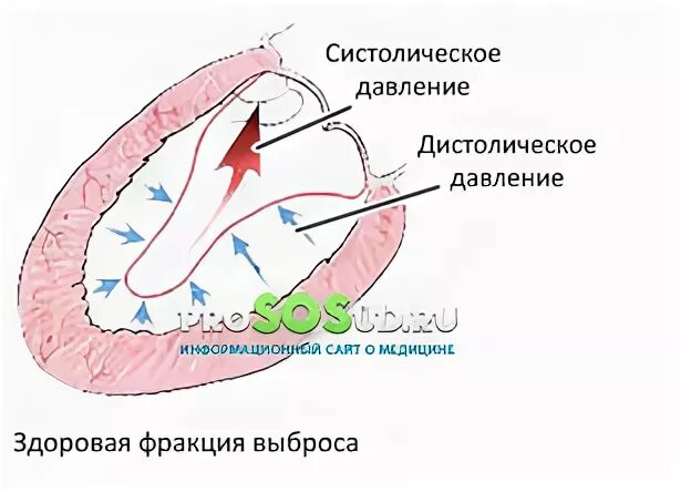 Фракция выброса по симпсону и тейхольцу. Оценка фракции выброса левого желудочка. Сердце функция выброса. Сердце функция выброса. Фракция изгнания левого желудочка норма.