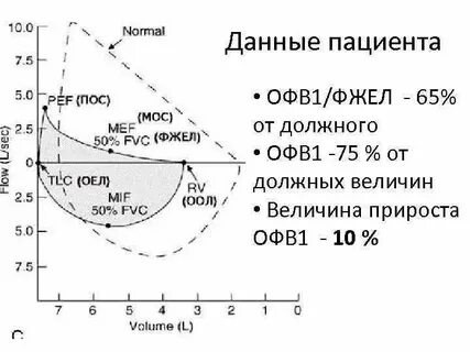 Прирост офв1
