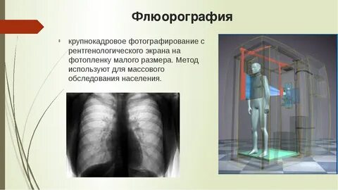 Флюорография легких где сделать