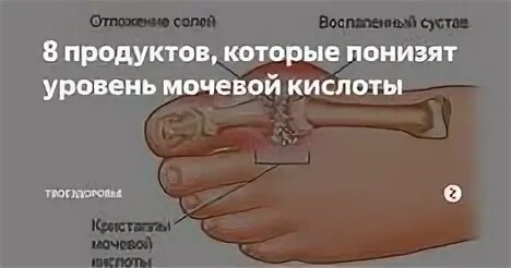 Мочевая кислота натощак