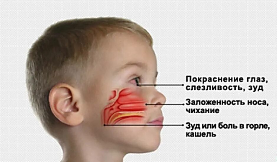 5 лет заложен нос