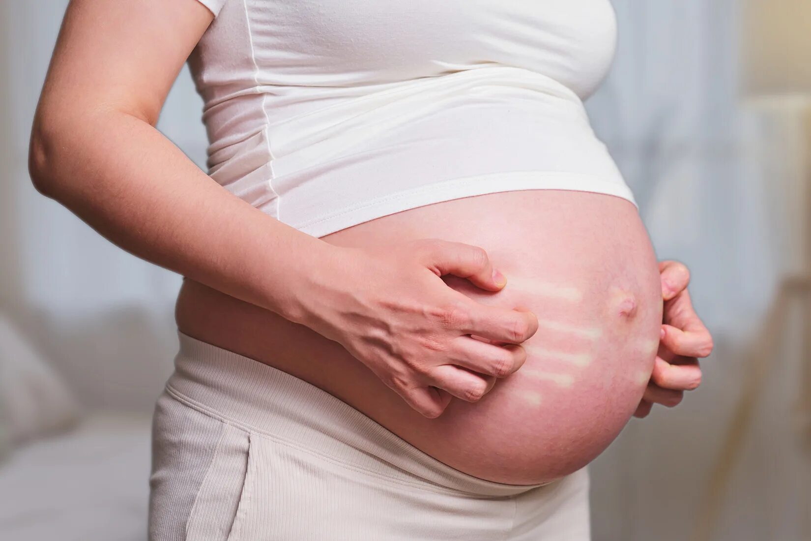 Во время беременности появляется. Дерматоз беременных фото. Полиморфный дерматоз беременных.