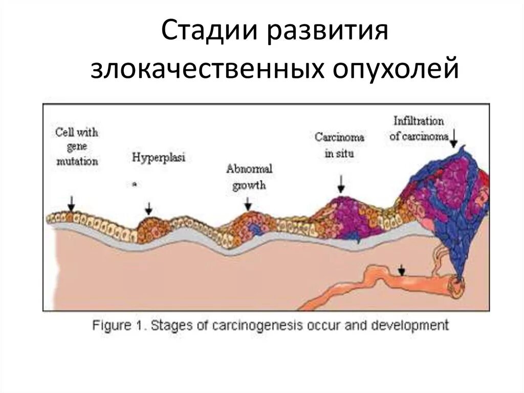 Как быстро развивается опухоль