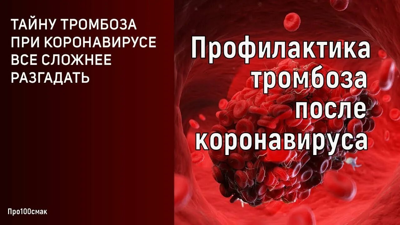 Лекарства от тромбов после коронавируса. Лекарство от тромбоза после коронавируса. От тромбов после коронавируса. Профилактика тромбообразования. Профилактика тромбоза после