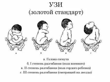 Положение в1