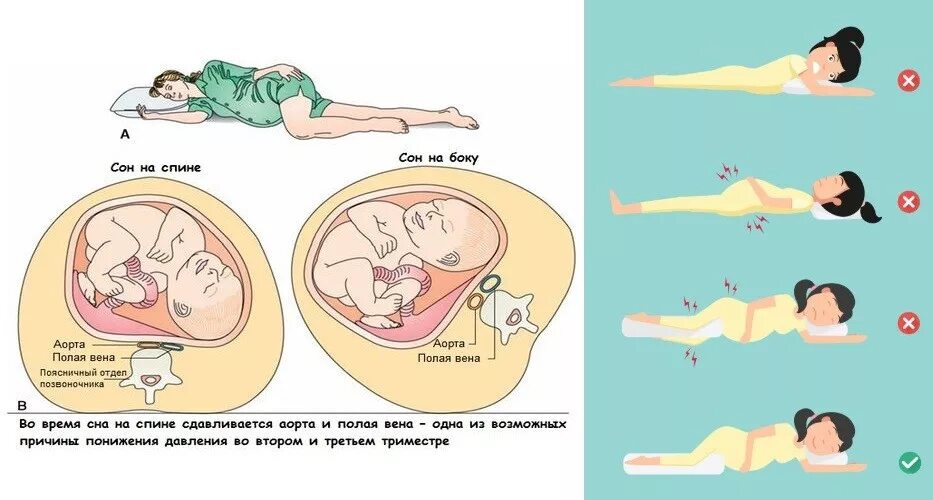 Позы при беременности. Позы для сна при беременности 3 триместр. Позы для сна при беременности 1 триместр. Позы для сна во 2 триместре беременности. Позы сна для беременных 2 триместр.