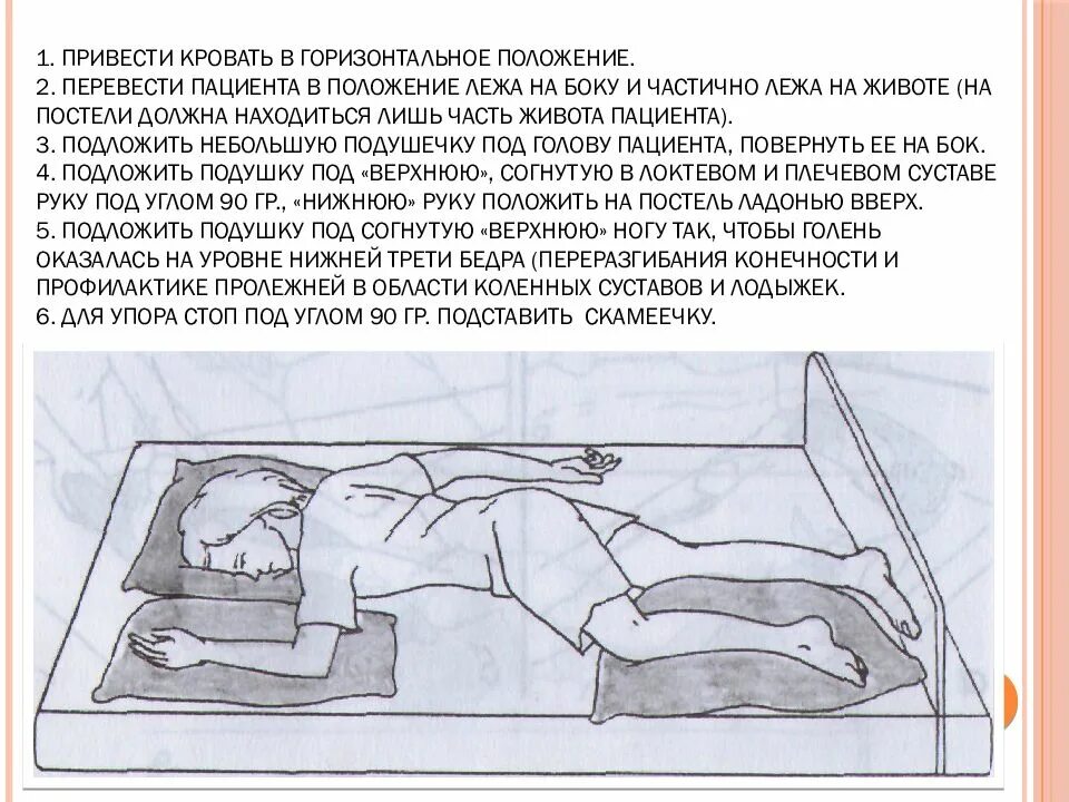 Спящий ковид. Положение на животе при коронавирусе. Положение пациента лежа на животе. Горизонтальное положение больного. Положение тела больного.