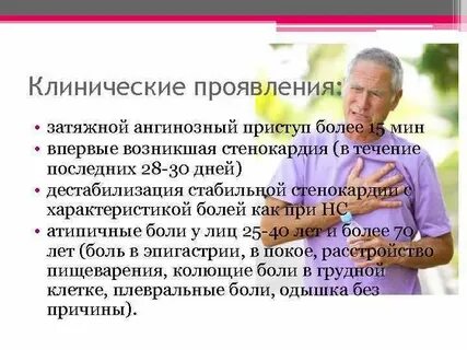 Ангинозный приступ стенокардии