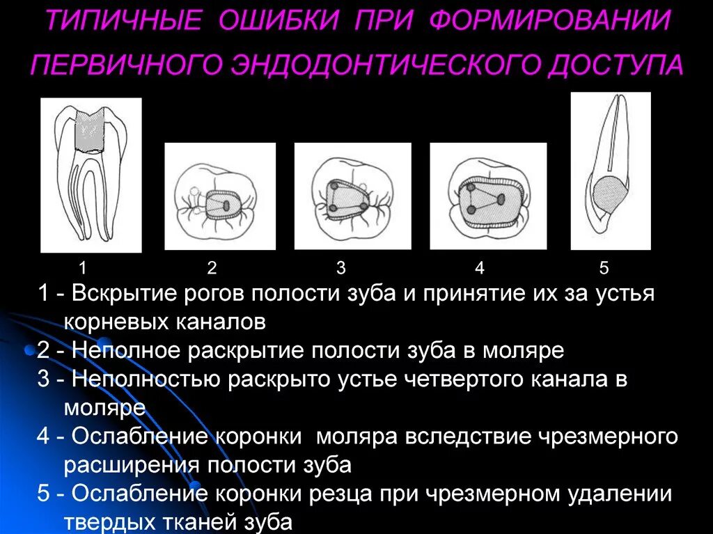 Формирование доступа к полости зуба этапы. Раскрытие полости зуба этапы эндодонтия. Этапы вскрытия полости зуба эндодонтия. Эндодонтия корневых каналов этапы. Формы корневых каналов