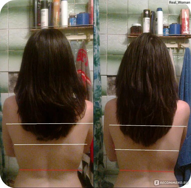 Для роста волос. Ополаскивание волос крапивой до и после. Волосы до и после рост волос. Крапива для роста волос.