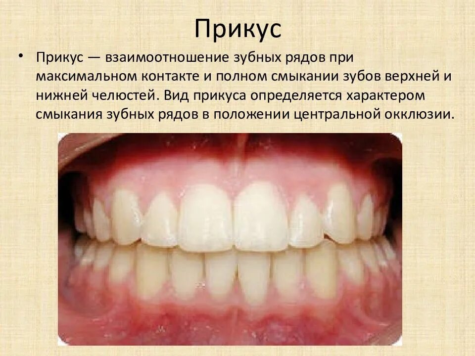 Зубы при закрытом рте. Правильный прикус у человека. Правильное смыкание зубов. Правильный прикус зубов у человека.