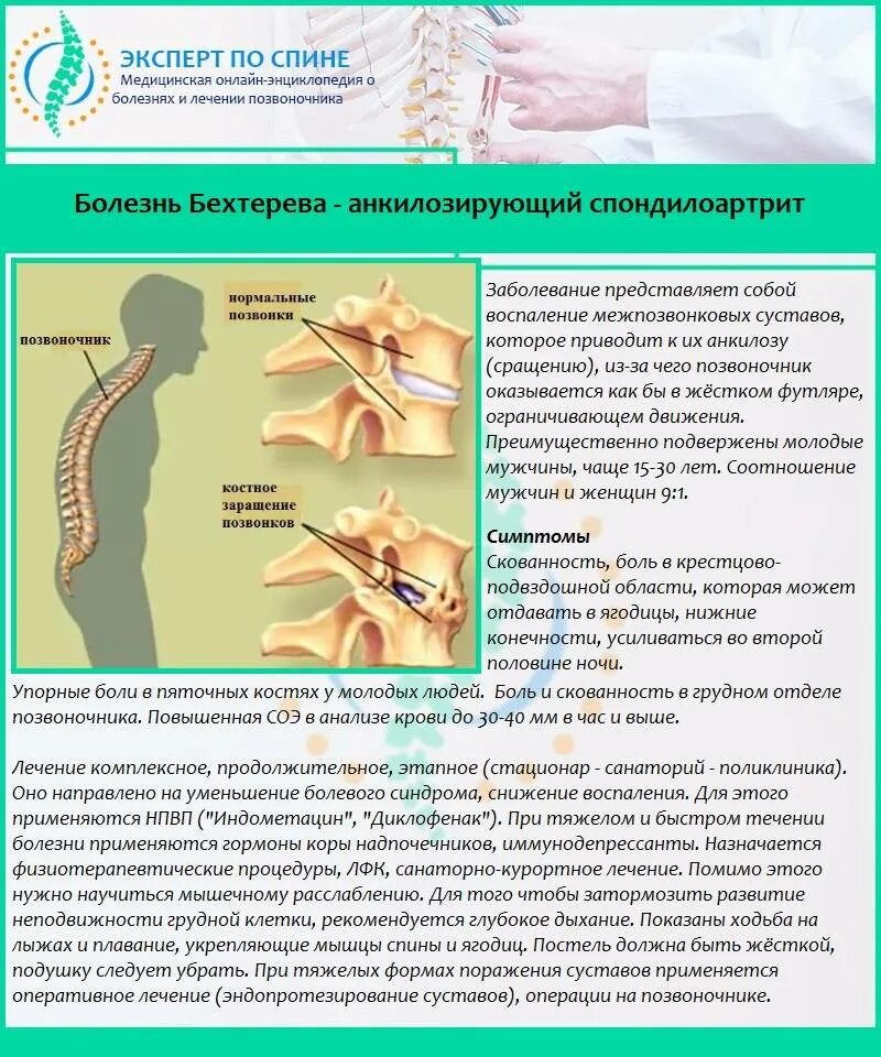 Сколько лечится позвоночник. Болезнь Бехтерева грудного отдела позвоночника. Поражение позвоночника при болезни Бехтерева. Анкилозирующий спондилоартрит болезнь Бехтерева. Болезнь Бехтерева шейного отдела.