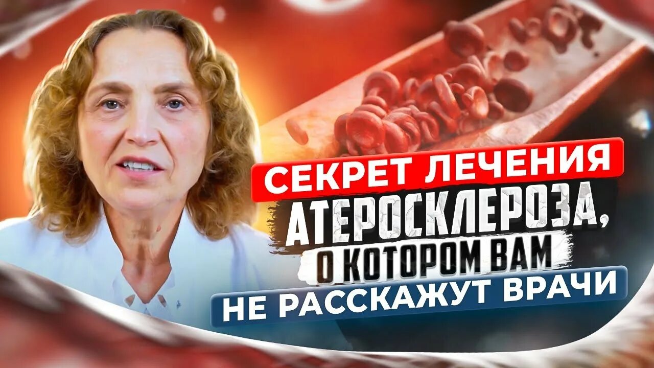 Лечим атеросклероз сосудов ног. Атеросклероз головного мозга. холестериновые бляшки в сосудах. атеросклероз бляшка врач. атеросклероз сосудов фото на теле.