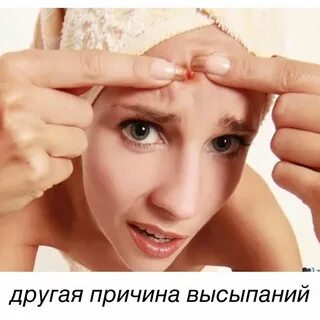 Черные угри выдавливание угрей видео ютуб