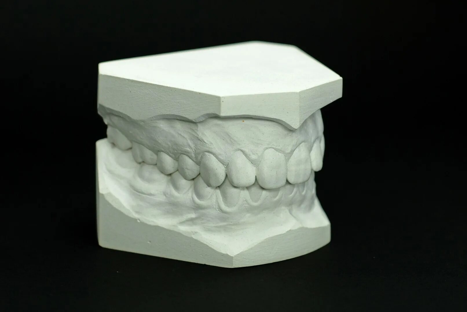 Изготовление гипсовой модели. Гипсовая модель зубов. Гипсовые модели челюстей. Рабочая гипсовая модель. Модели стоматологические гипсовые.