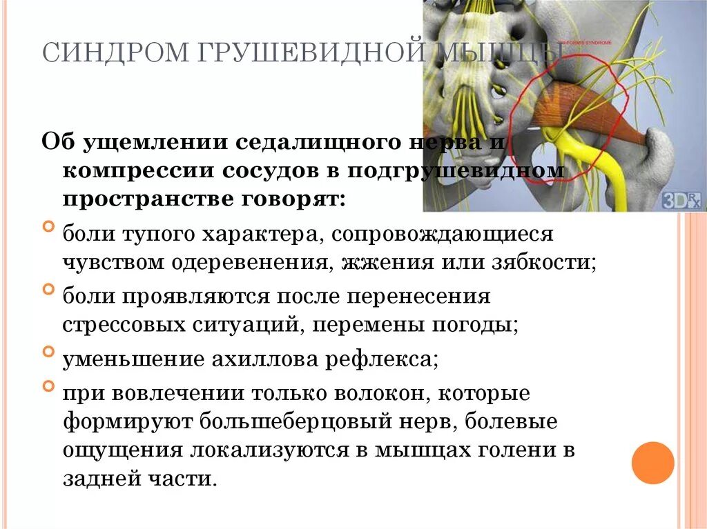 Симптомы боли седалищного нерва у мужчин. Синдром грушевидной мышцы симптомы. Синдром мышевидной мышцы. Признаки синдрома грушевидной мышцы. Синдром грушевидной мышцы и седалищный нерв.