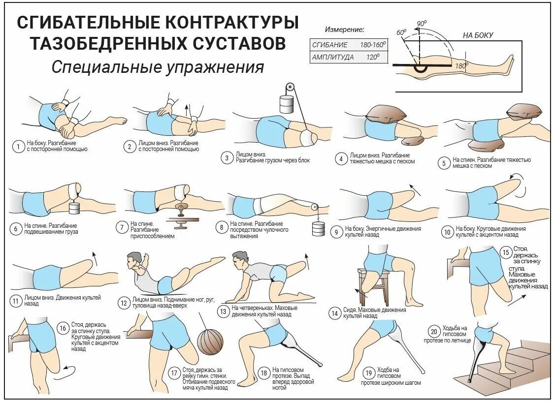 Замена коленного сустава гимнастика