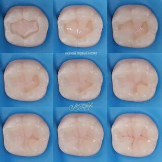 Анатомия Моляров - 59 Фото