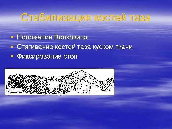 Множественные переломы таза. Открытый перелом таза. Открытый перелом таза. Иммобилизация при травме костей таза. При переломе позвоночника и костей таза возникает паралич чего.