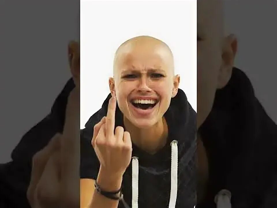 Ногу свело поможите. Лысая девочка ногу свело. Ногу свело сибирская любовь. Группа свел екатеринбург фото. Лысая девушка гуляет на улице.