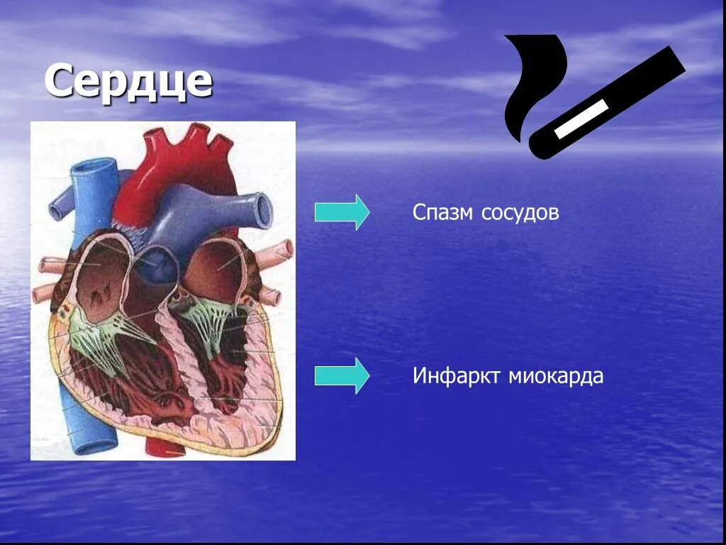 Спазм сердца. Спазм сосудов что с сердечной мышцей.