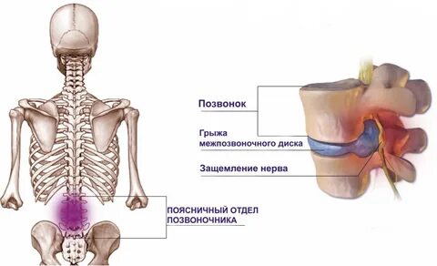 Пятно на крестце