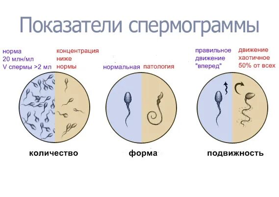 Подготовка к спермограмме. Мужское бесплодие. Как понять что ты бесплоден у мужчин. Как определить мужское бесплодие. Что будет если кончить в мужчину