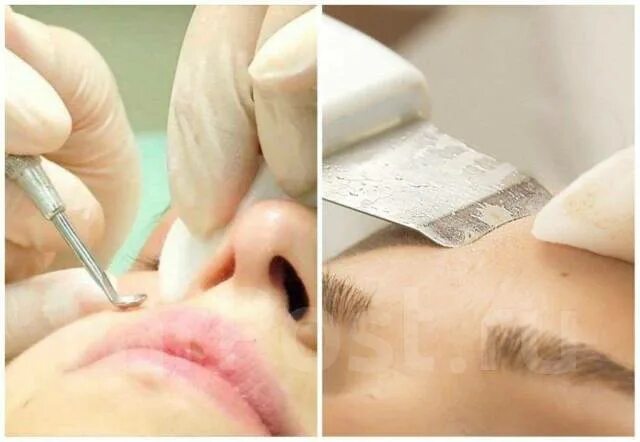 Как выглядит комбинированная чистка лица You Beauty, beauty salon, Pargolovo Settlement, Fyodora Abramova Street, 21к1
