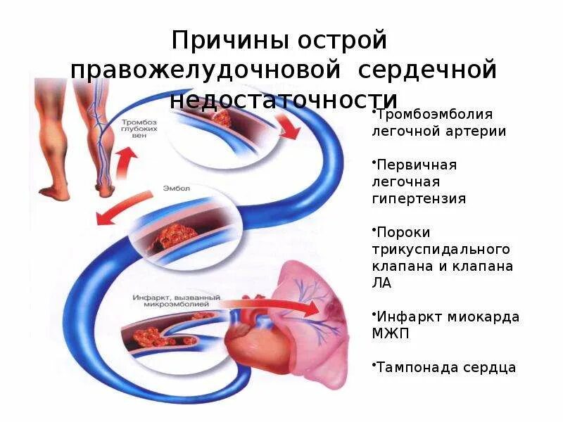 Недостаточность кровообращения. Степени недостаточности кровообращения. Степени недостаточности кровообращения у детей. Стадии острой недостаточности кровообращения. Гемодинамика у детей