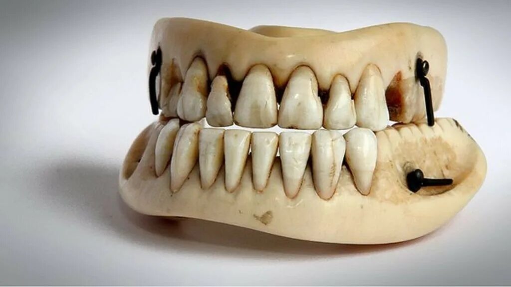 Зубные протезы Ватерлоо. Рога зубов