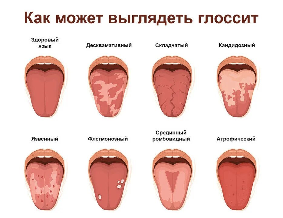 Какой язык чаще встречается