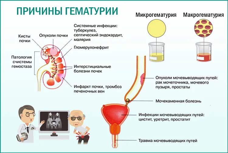 После мочеиспускания болит мочевой. Мочекаменная болезнь гематурия.