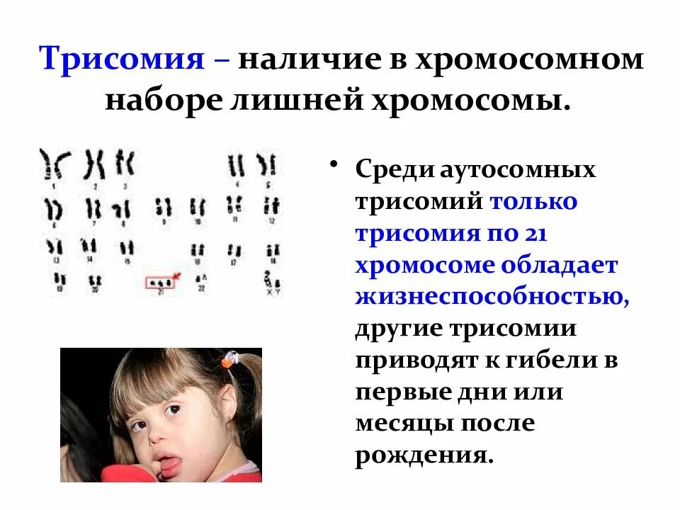 Синдром трисомии хромосомы 8. Синдром трисомии хромосомы. Трисомия в хромосомном наборе. Болезнь с лишней хромосомой