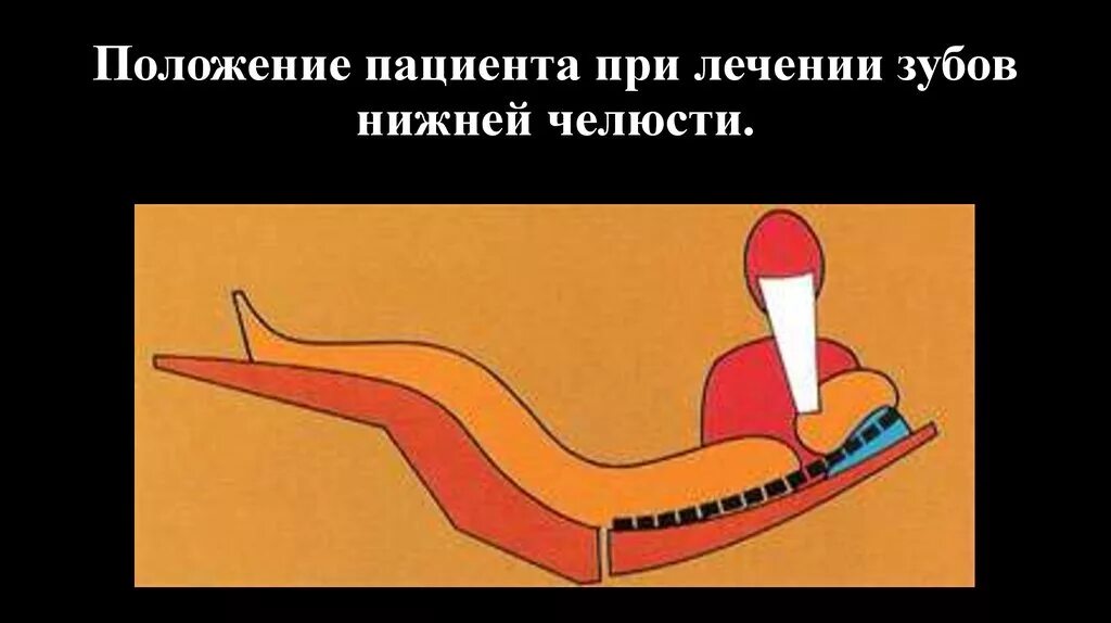 Положение врача при удалении. Положение врача при лечении нижней челюсти. эргономика в стоматологии. положение пациента при удалении зуба.