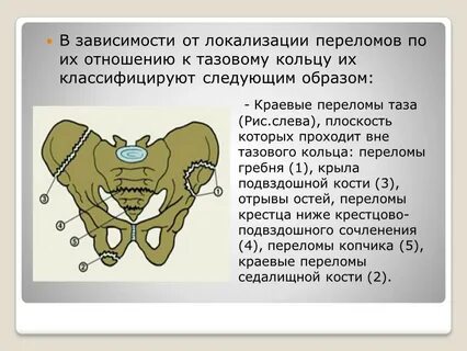 Тазовое кольцо