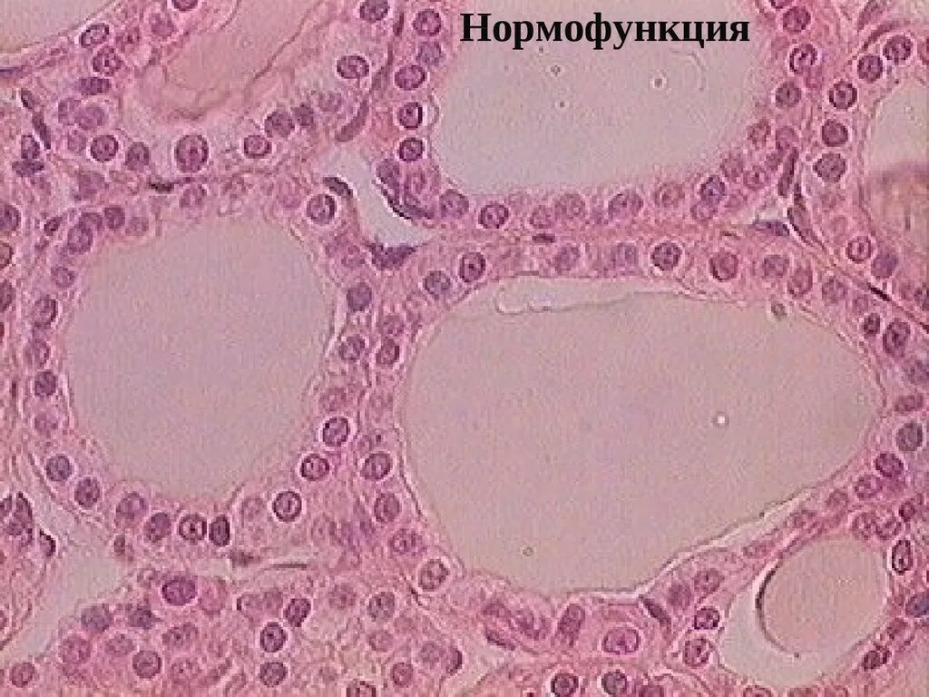 Срез щитовидной железы. Паращитовидная гистология препарат. Клетки паращитовидной железы гистология. Паращитовидная железа гистология. Щитовидная железа гистология препарат.