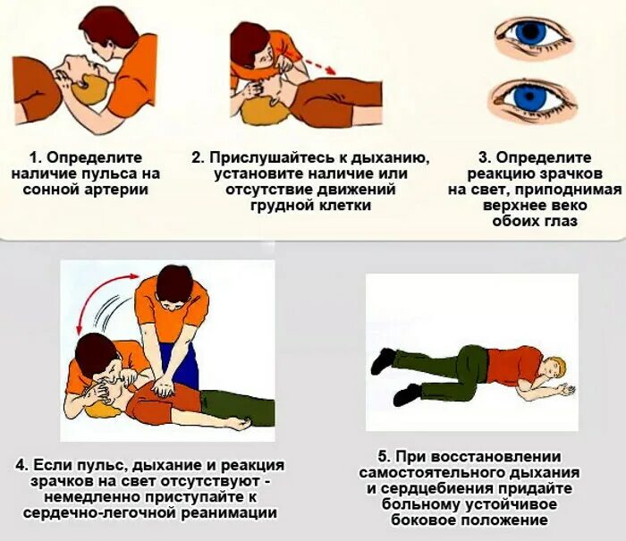 Не могу пописать первая помощь. При обмороке первая помощь инсульт. Алгоритм оказания первой помощи при остановке сердца и инсульте. Алгоритм 1 помощи при сердечно легочной реанимации. Ердечно-легочная реанимация (СЛР).