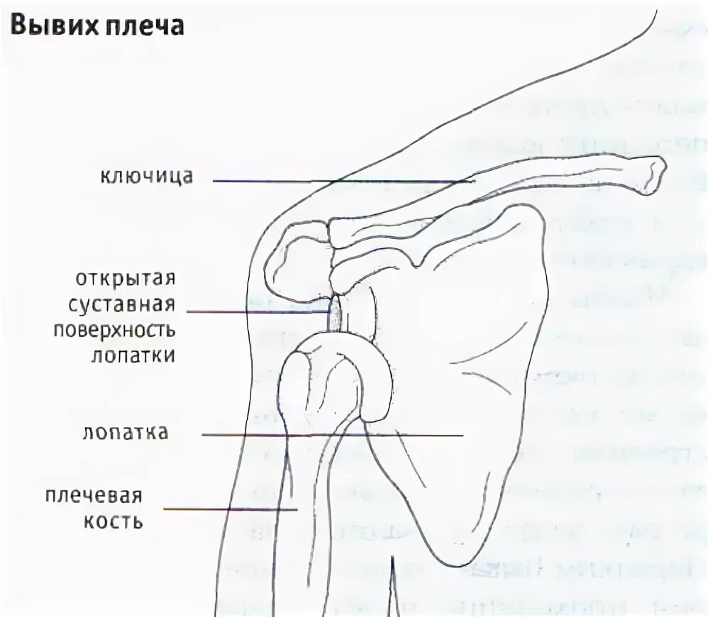 Боль в плечевом суставе правой руки. Болит плечевой сустав левой. Плечевой сустав левой руки. Болит плечевой сустав левой руки. Ноет левое плечо и предплечье.