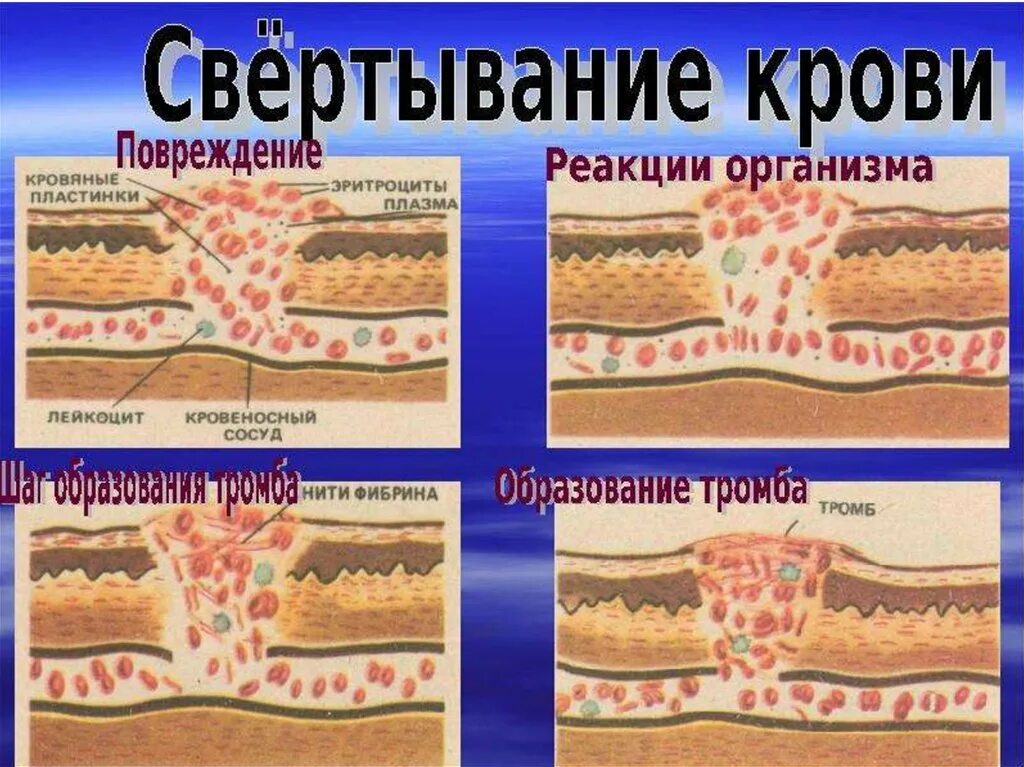 Процесс свертываемости крови. Образование сгустка крови. Процесс свертывания крови рисунок. Свертывание крови группы крови