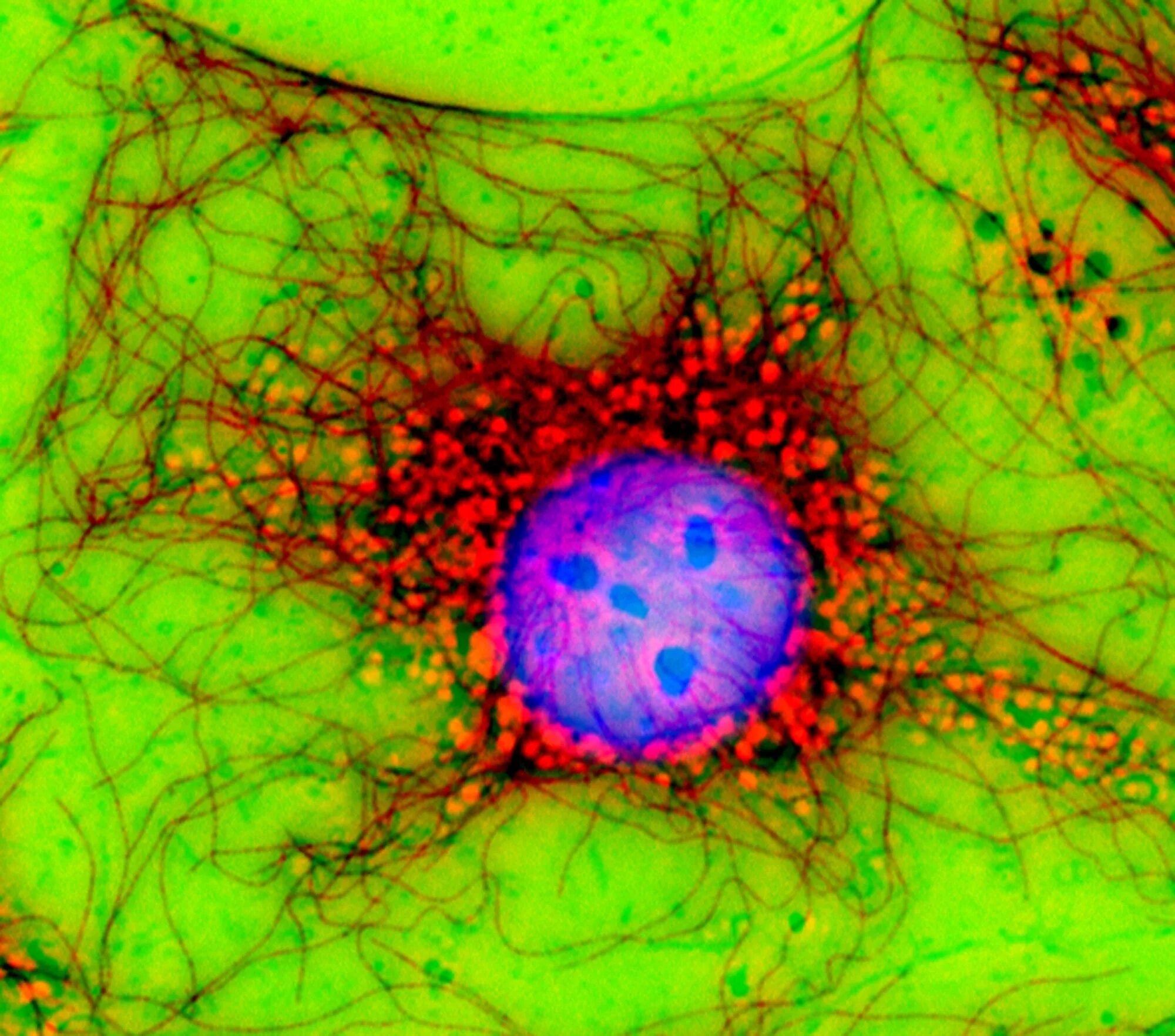 Цитоскелет флуоресцентная микроскопия. Цитоскелет клетки в микроскопе. Митоз флуоресцентная микроскопия. Цитоскелет микрофотография. Клетки с гиперхромными ядрами