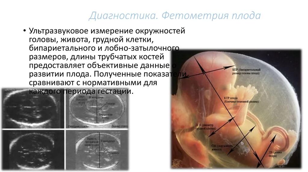 Окружность головы плода. Измерение окружности головы плода по УЗИ. Контрольное УЗИ фетометрия. Измерение трубчатых костей плода. Анатомия плода БПР.