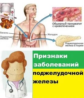 Острый панкреатит печени