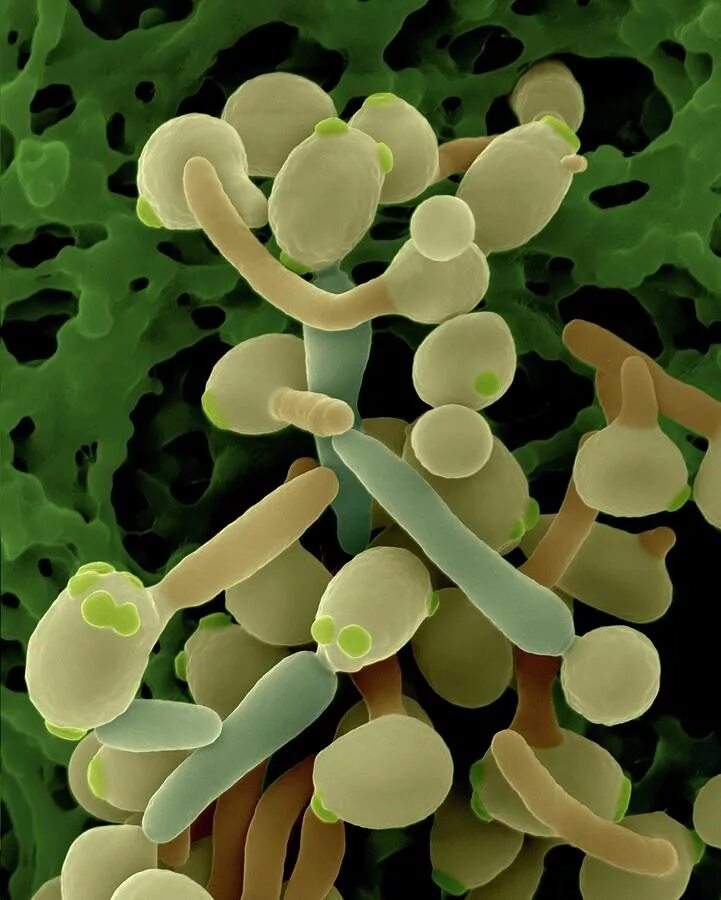 Молочница гриб. Дрожжеподобный гриб Candida albicans. Грибки рода Candida.