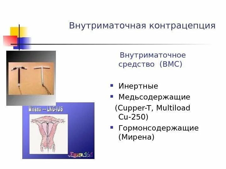 Как работает внутриматочная спираль. Внутриматочная контрацепция. медьсодержащая внутриматочная спираль. внутриматочные методы контрацепции. введение вмс.